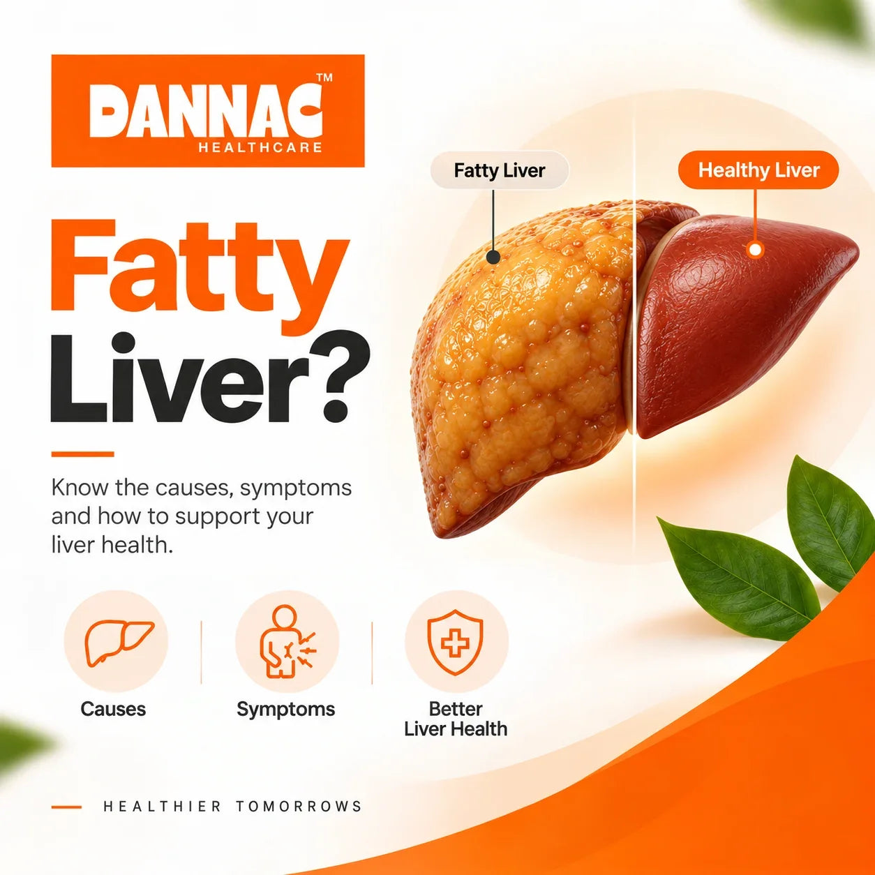 What Is Fatty Liver? Causes, Risk Factors and Symptoms